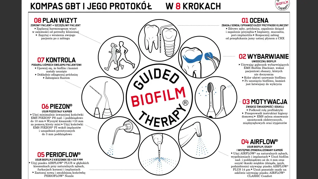 Po higienizacji można jeść, gdy biofilm i kamień zostaną usunięte, a zęby zabezpieczone fluorem.