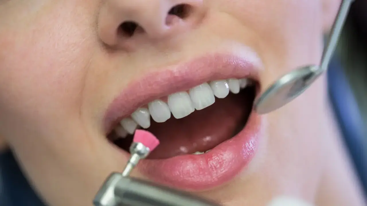 Profesjonalne usuwanie kamienia nazębnego. Dentysta poleruje zęby pacjentki małą, różową szczoteczką.