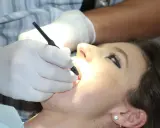 Dentysta wykonuje piaskowanie zębów. Sprawdź piaskowanie zębów cenę i zadbaj o piękny uśmiech.