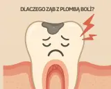 Ilustracja zęba z plombą, smutną miną i czerwonymi błyskawicami bólu.