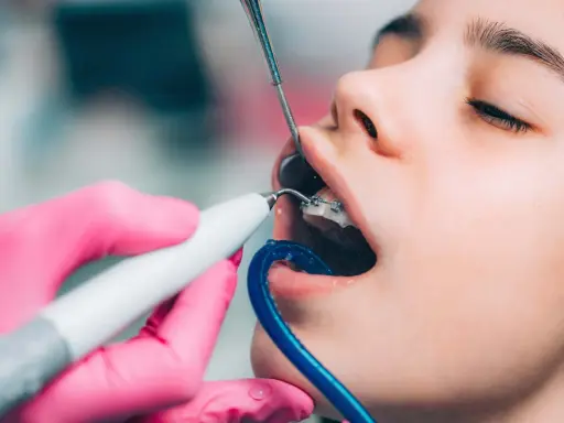 Dieta z aparatem ortodontycznym: co jeść, czego unikać i jak przetrwać?