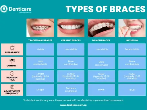 Porównanie aparatów ortodontycznych: tradycyjne, ceramiczne, Damon i Invisalign. Zęby wysunięte do przodu mogą być korygowane.