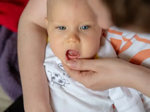Dłoń rodzica delikatnie podnosi wargę niemowlaka, ukazując dziąsła.