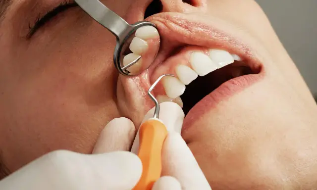 Dentysta wykonuje skaling zębów, używając narzędzi i lusterka.