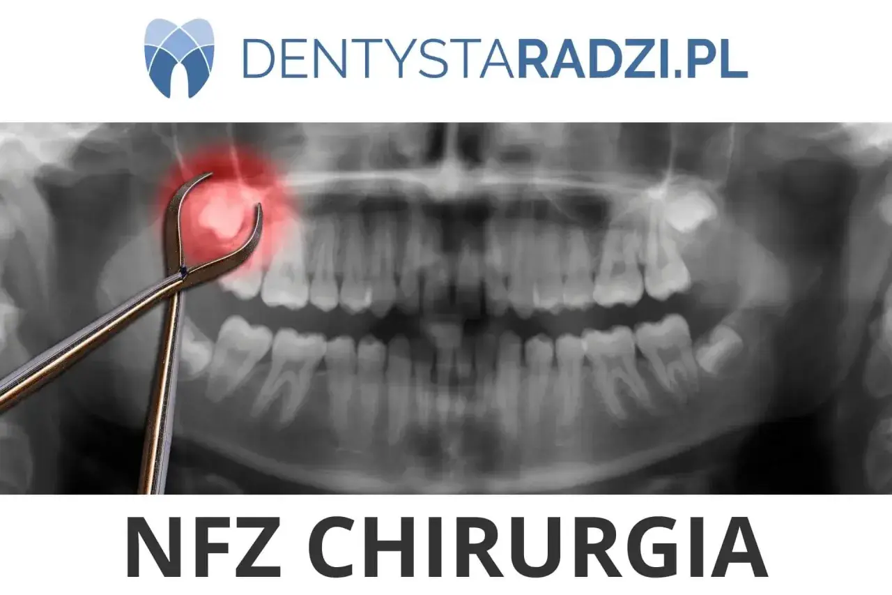 Rentgen zęba z kleszczami i czerwoną plamą. Dowiedz się, ile kosztuje wyrwanie zęba w NFZ chirurgia.