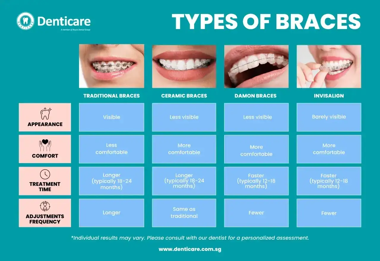 Porównanie aparatów ortodontycznych: tradycyjnych, ceramicznych, Damon i Invisalign. Idealne dla dzieci, każdy typ ma inne cechy wyglądu, komfortu i czasu leczenia.