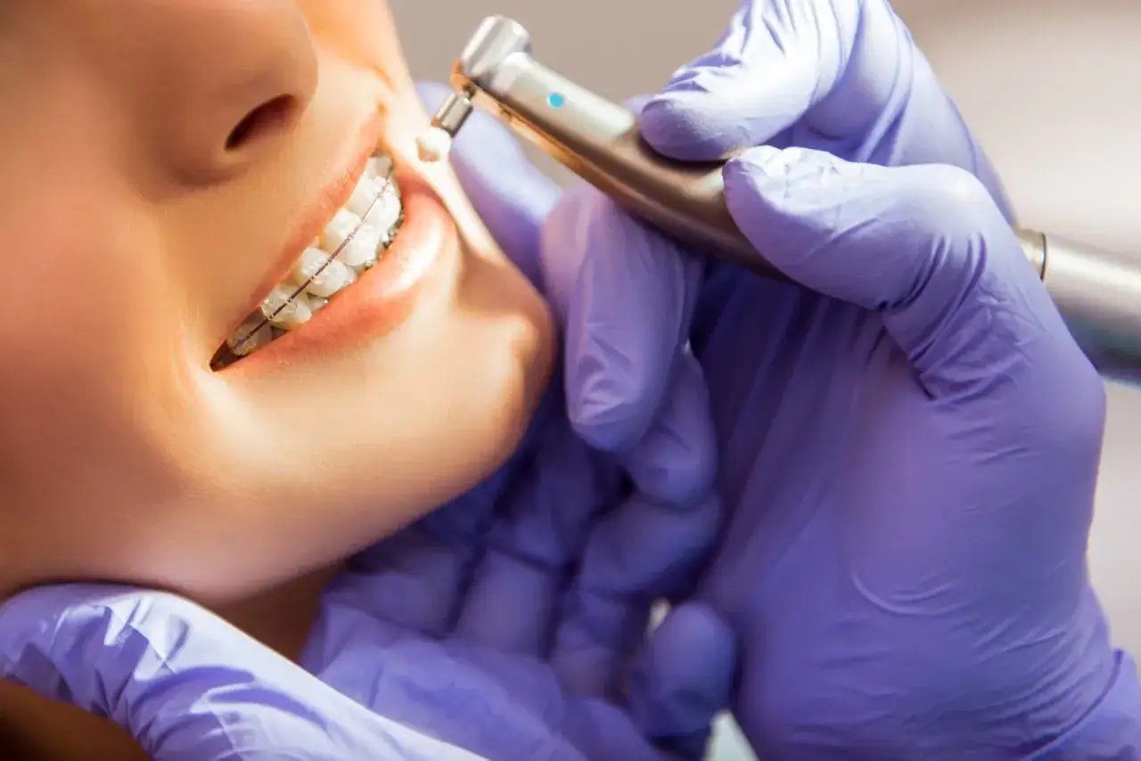 Dentysta wykonuje czyszczenie aparatu ortodontycznego uśmiechniętej pacjentki.