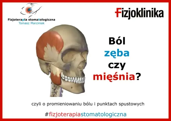 Anatomia czaszki z zaznaczonymi mięśniami. Czy to ból zęba czy mięśnia? Fizjoterapia stomatologiczna.