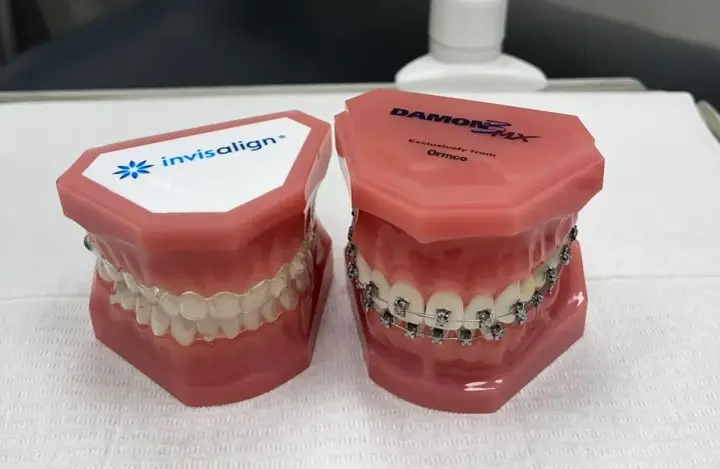 Modele szczęk pokazują tradycyjny aparat ortodontyczny i przezroczyste nakładki Invisalign. Dowiedz się, co to Invisalign i jak działa.